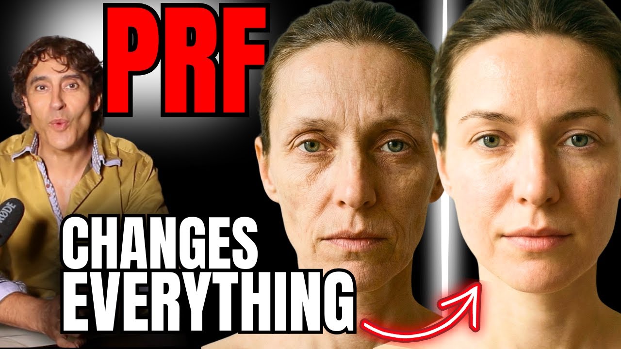 The Ultimate PRF Masterclass - Why It’s Transforming Aesthetics