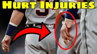 MLB | Creepy Injuries 3
