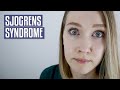 SJOGRENS SYNDROME REVISITED | Signs & Symptoms, My Experience