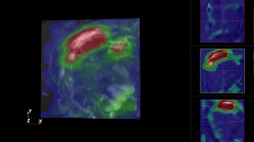 3D class activation map change during training