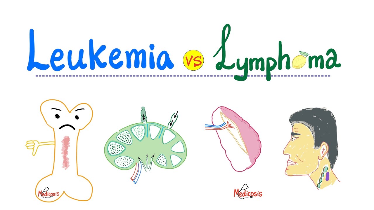 Leukemia and Lymphoma Introduction...Distinctions in oncology
