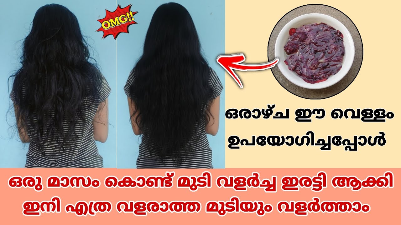 💯🔥 7 ദിവസം ഈ വെള്ളം ഉപയോഗിക്കൂ എത്ര വളരാത്ത മുടിയും പനങ്കുല പോലെ വളരും  😱🔥 Hair Growth Malayalam ✅💯