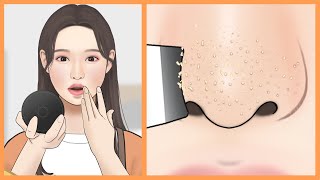 [ASMR] 코 피지 제거 / 피부 케어 애니메이션 /WHITEHEADS IN NOSE REMOVAL / SKIN CARE ANIMATION