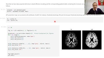 Focus on Q-Space Trajectory Imaging (QTI) - part 2 -  Practise