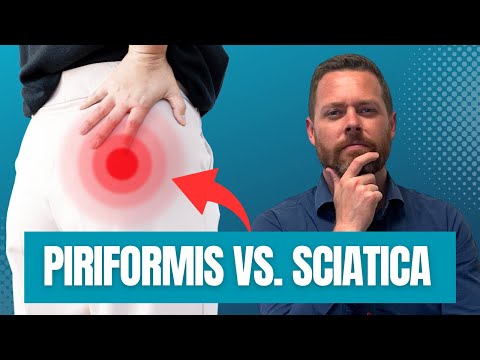 Video: Bolehkah bursitis trochanteric menyebabkan sciatica?