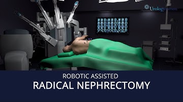 Robot Assisted Radical Nephrectomy