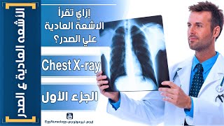 إزاي تقرأ الاشعه العادية علي الصدر؟ | (Chest X-ray) الجزء الاول screenshot 2