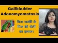 Gallbladder Adenomyomatosis symptoms &amp; homeopathic medicine बिना सर्जरी के पित्त की थैली का इलाज !!