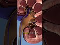 How Ureteroscopy Removes Kidney Stones 🇱🇷 (3D Animation