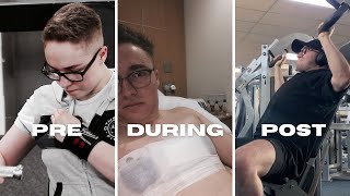 YOUR FULL TOP SURGERY TIMELINE | Training, Nutrition, Etc.