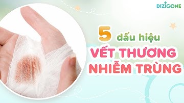 Vết thương nhiễm trùng: 5 dấu hiệu nhận biết cơ bản