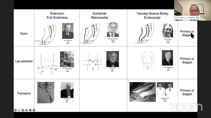 Current Topics in Hirschsprung Disease Workshop