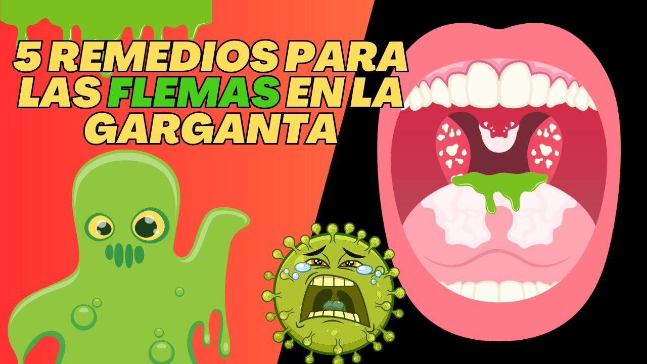 Flema 5 REMEDIOS NATURALES PARA LAS FLEMAS! - YouTube