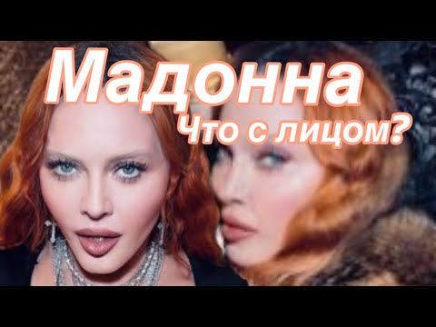 УЖАСНА ИЛИ КРАСИВА? Объясняю , что певица Мадонна сделала с лицом ? #madonna #мадонна #usa
