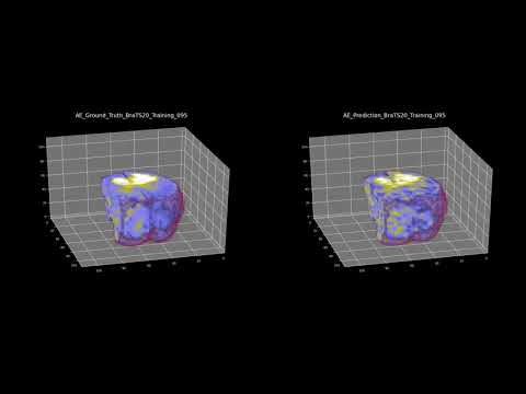 BraTS2020 3d Unet and 3d AutoEncoder - YouTube