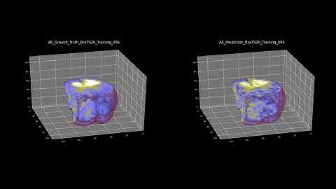 BraTS2020 3d Unet and 3d AutoEncoder