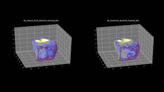 BraTS2020 3d Unet and 3d AutoEncoder