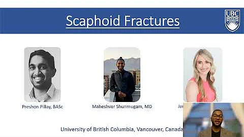 An Approach to Scaphoid Fractures