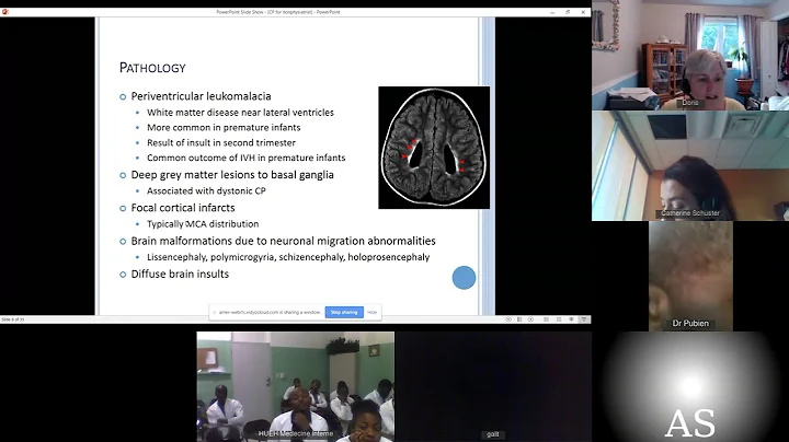 07/24/2019 Dr. Catherine Schuster Cerebral Palsy f...