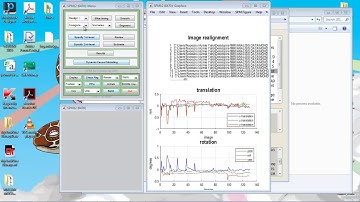 3 fMRI SPM coregister