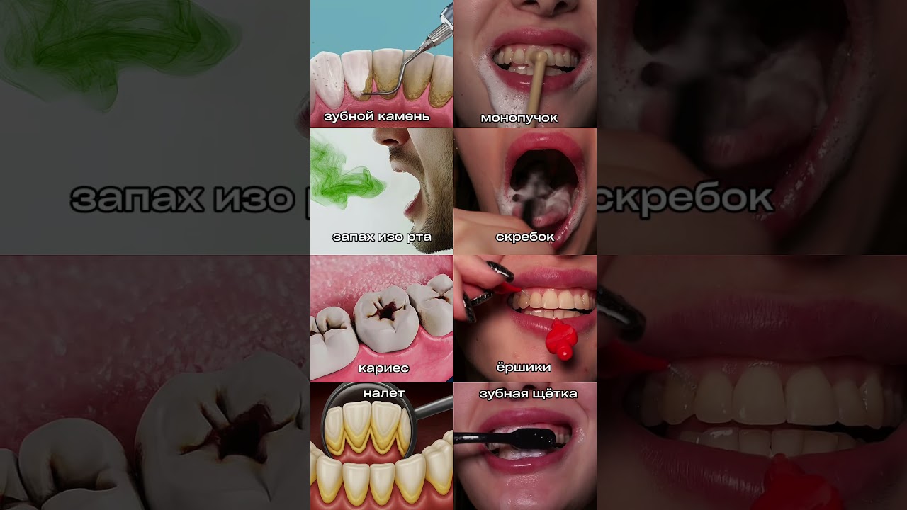 Проблема - решение🫱🏼‍🫲🏾 Монопучок - WW22656 1Щётка - WW215956 Ёршики - WW226562