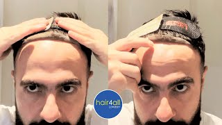 How To Apply Tape, Adhesive & Fit Hair System Non-Surgical Hair Replacement System Men/Women UK/USA