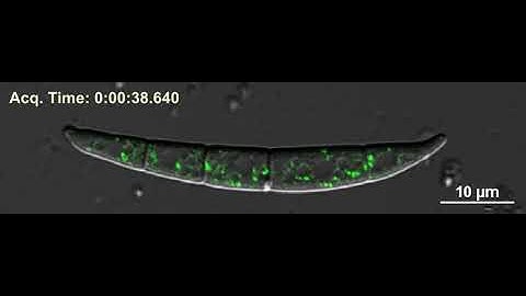 Video S3 Dynamics and mobility of FgVps35-GFP.