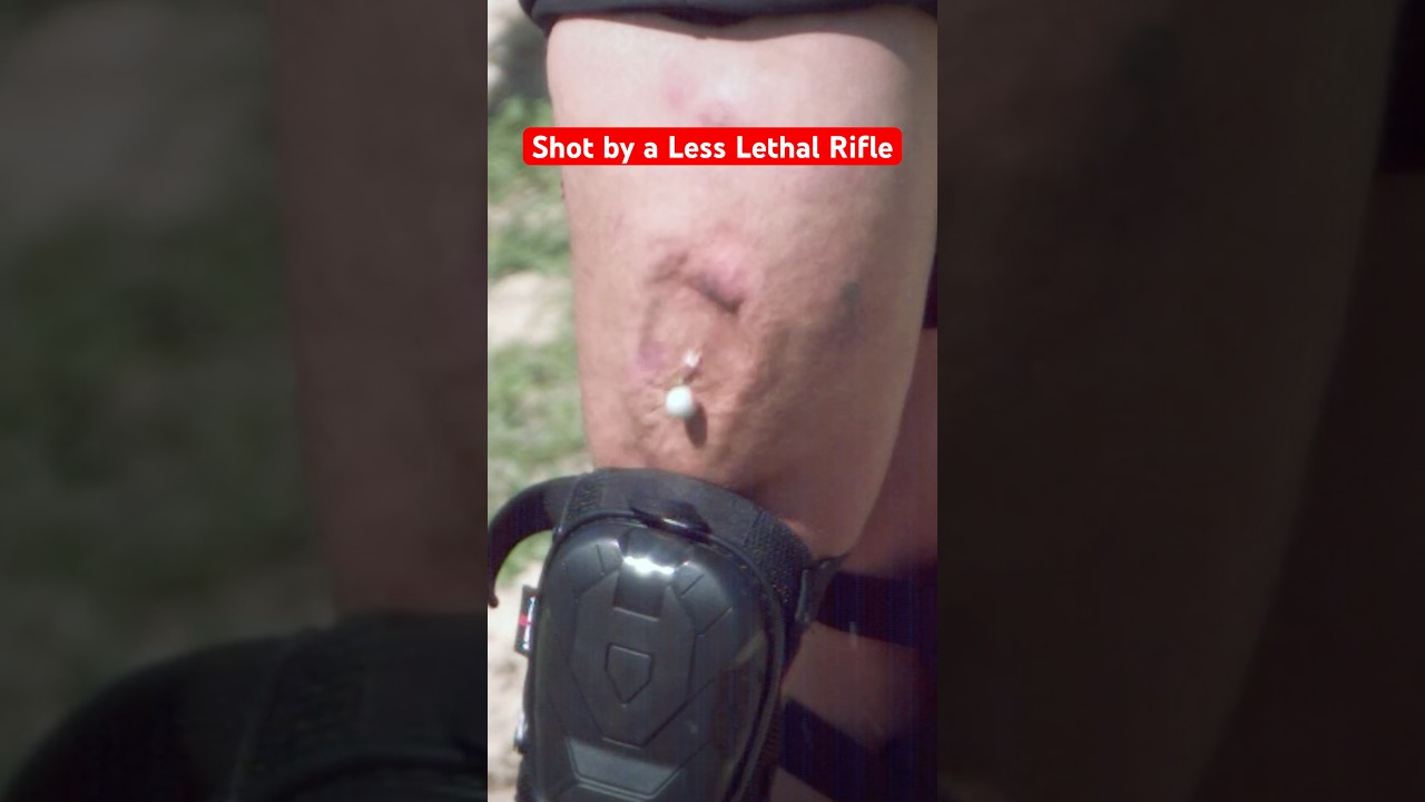Shooting a HOLE in my Leg for Science! (Ft. Kentucky Ballistics) #funny #memes #science