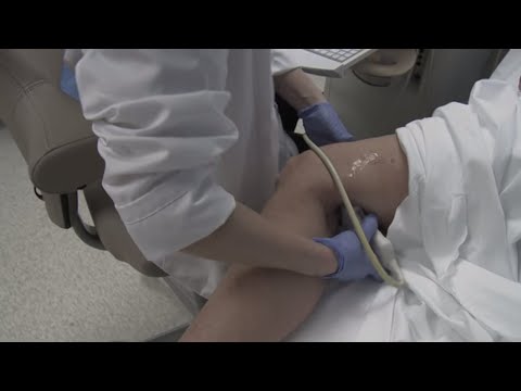 Video: Kaip sustabdyti krešulių atsiradimą?