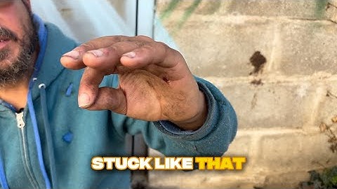 Fingers Stuck  Homeless and Addicted | Roberto’s Story
