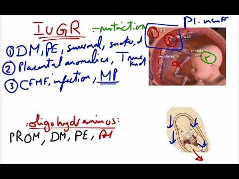 Video: Th2 Iekaisuma Samazināšana, Neitralizējot IL-4 Antivielas, Izglābj Mielinizāciju IUGR žurku Smadzenēs