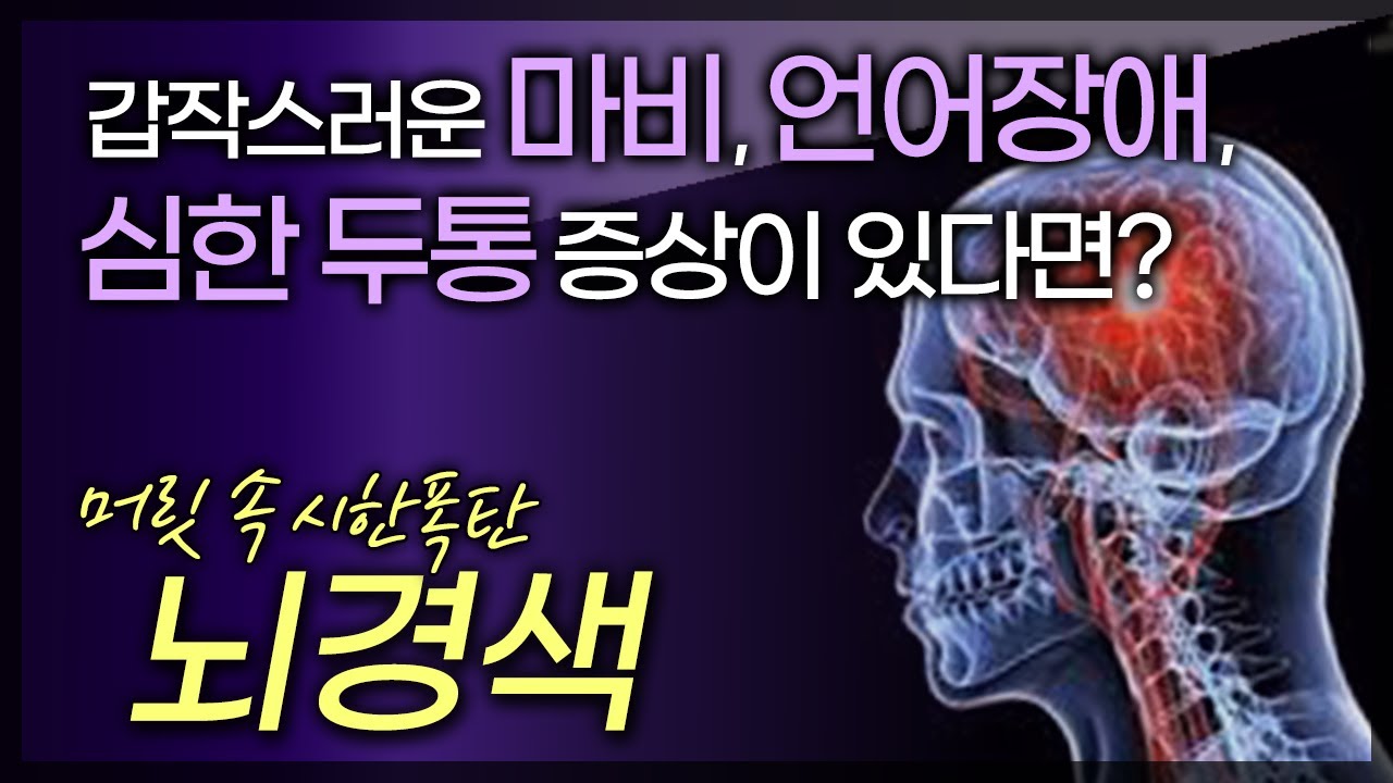 갑작스러운 마비, 언어장애, 심각한 두통이 있다면? 의심해보아야 합니다 / 한국인의 3대 사망원인 뇌혈관질환 / 부산MBC TV 닥터인사이드 20150119 방송