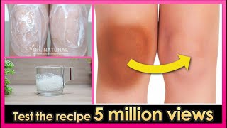 How to lighten Dark Knees and Elbows fast at home. (Test the recipe 5 million views, Work or not?)