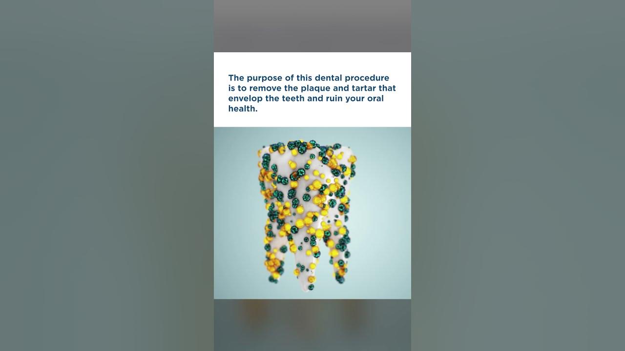 dental-cleaning-more-than-one-way-to-keep-your-teeth-clean-youtube