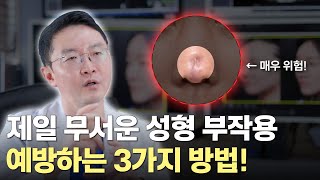 제일 무서운 성형 부작용, 구축코 예방하는 3가지 방법!