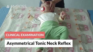 Asymmetrical Tonic Neck Reflex - Clinical Examination