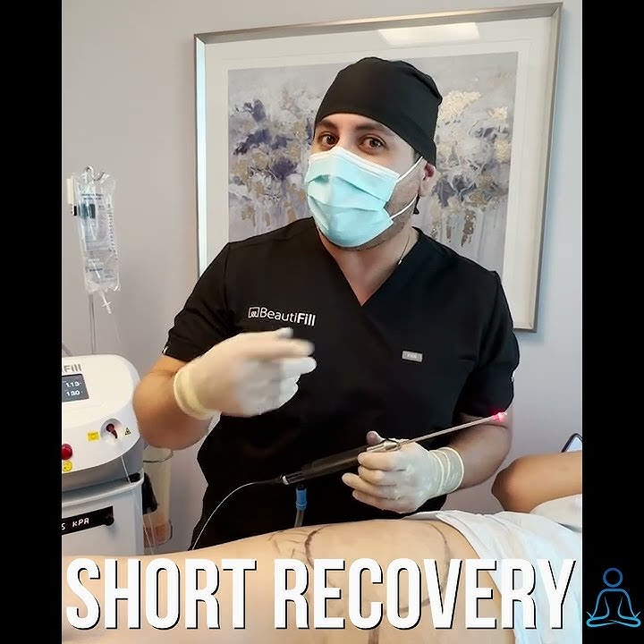 Awake Liposuction of Outer Thighs| Short