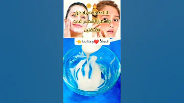تخلصي من احمرار واسمرار شمس المصيف في دقيقتين 