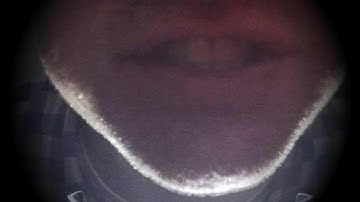 Stomatopod - "Precision Surgeon" (official video)