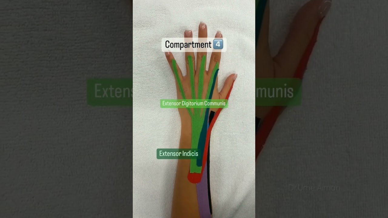 Wrist Compartments 