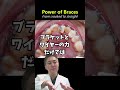 ゴムとワイヤーで歯を並べていきます😊#歯列矯正 #歯医者 #dentist #歯 #蒲田 #矯正 #歯並び