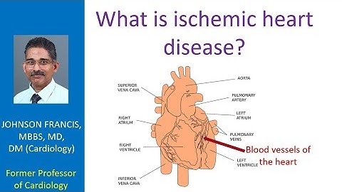 What is ischemic heart disease?