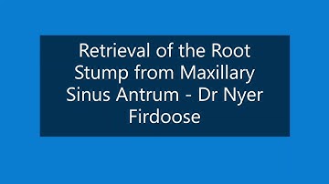 Retrieval of Root Stump from Maxillary Sinus - Dr Nyer Firdoose