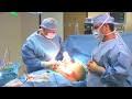 Miami Plastic Surgery - Tummy Tuck (Abdominoplasty) Surgery with Dr. Michael Kelly