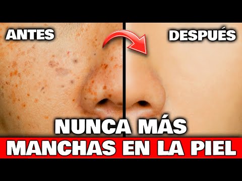 Video: 3 formas sencillas de curar la piel del rostro rápidamente