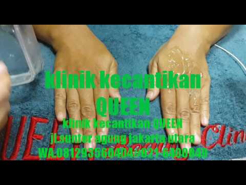 What Suntikan Filler Punggung