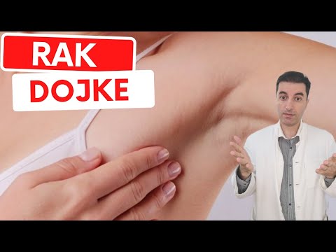 Video: Ali koreninski kanali povzročajo raka dojke?