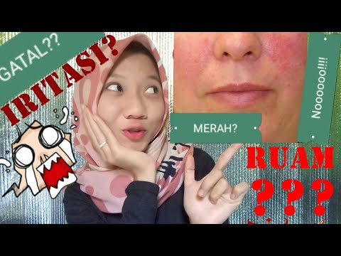 Video: Mengatasi Iritasi: Tips Bermanfaat