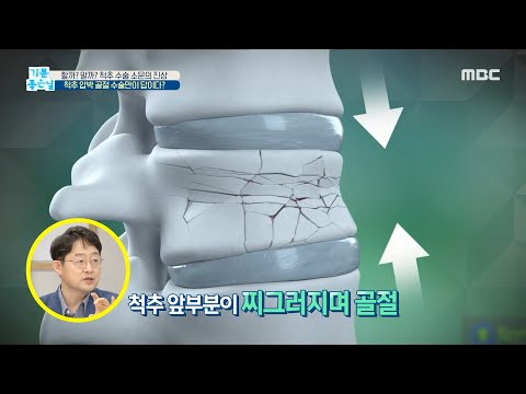 [기분 좋은 날] 척추 압박 골절, 수술만이 답이다?, MBC 210604 방송