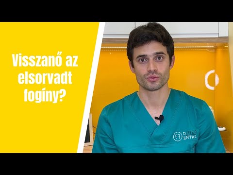 Videó: Visszanő a holdkórom?